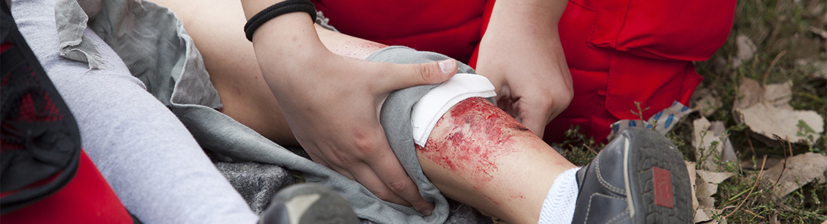 Bleeding Control Bleeding Control